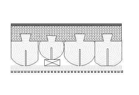 Stent (ARCHIPENTE)
